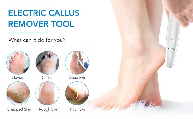 Electric Foot Callus Remover With USB Rechargeable Design Gently Buffs Away Dry Cracked Skin - Image 14
