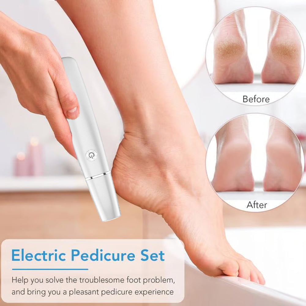 Electric Foot Callus Remover With USB Rechargeable Design Gently Buffs Away Dry Cracked Skin - Image 1