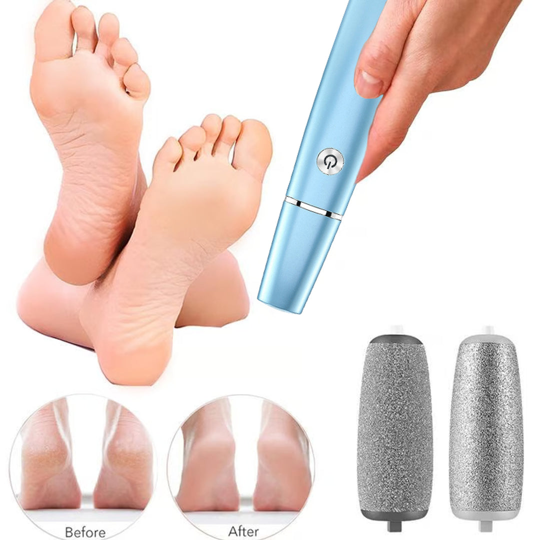 Electric Foot Callus Remover With USB Rechargeable Design Gently Buffs Away Dry Cracked Skin - Image 8