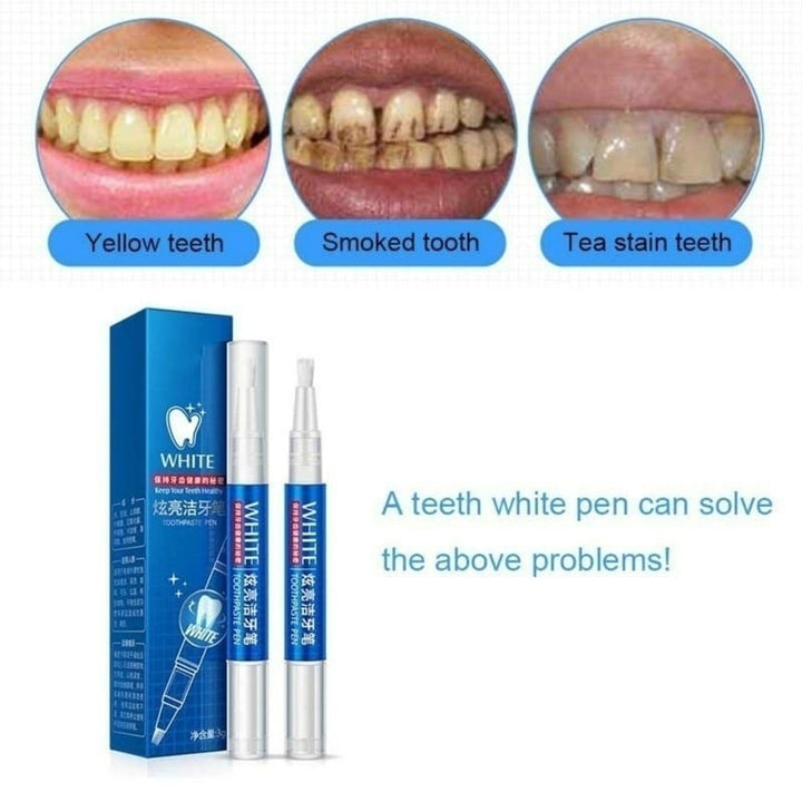 Magic Natural Tooth Whitening Gel Pen For Effective Stain Removal - Image 4